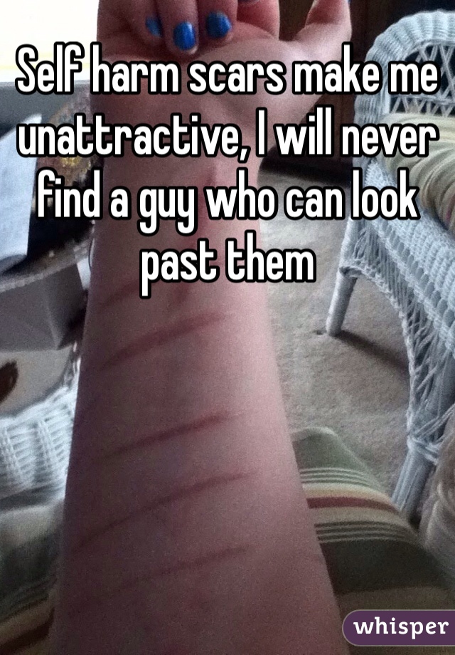 Self harm scars make me unattractive, I will never find a guy who can look past them