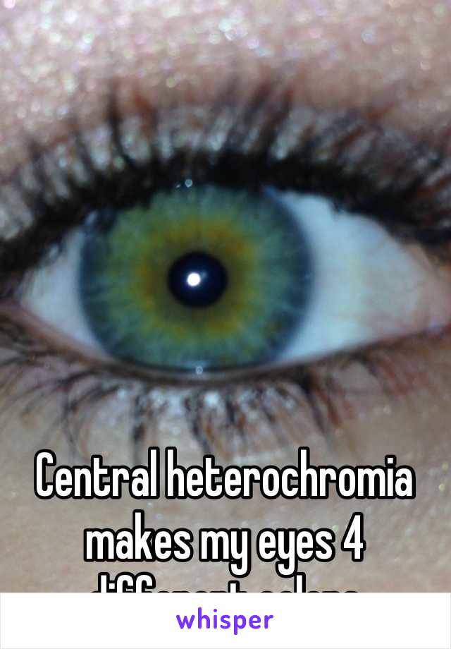 Central heterochromia makes my eyes 4 different colors