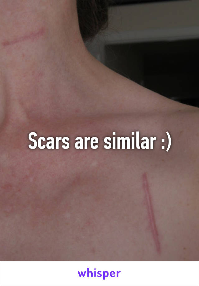 Scars are similar :)