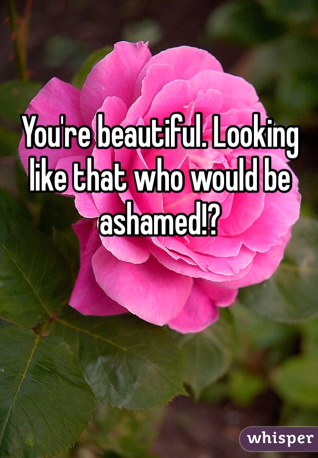 You're beautiful. Looking like that who would be ashamed!?