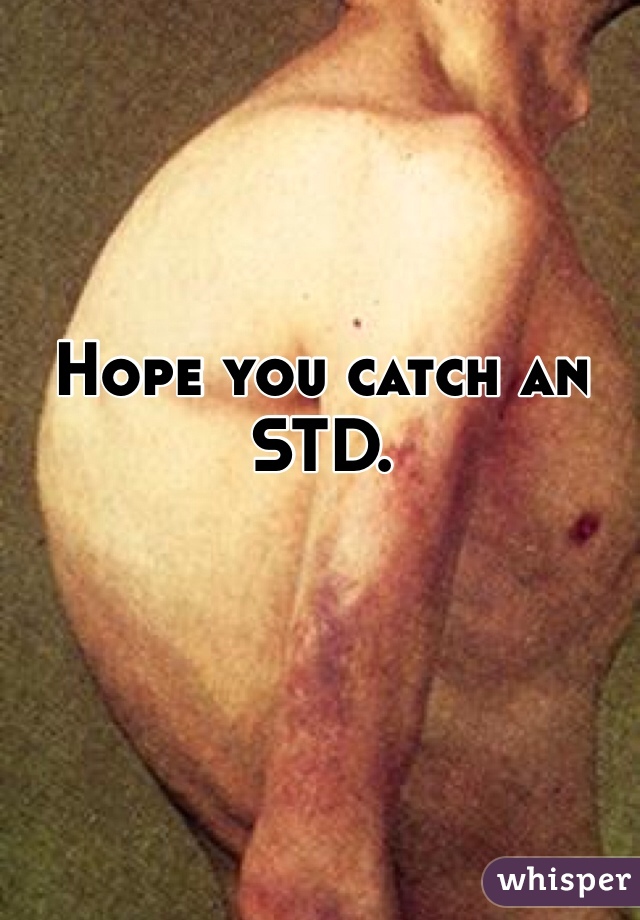 Hope you catch an STD. 