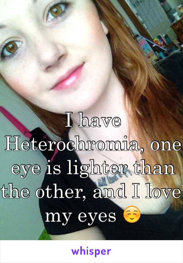 I have Heterochromia, one eye is lighter than the other, and I love my eyes ☺️