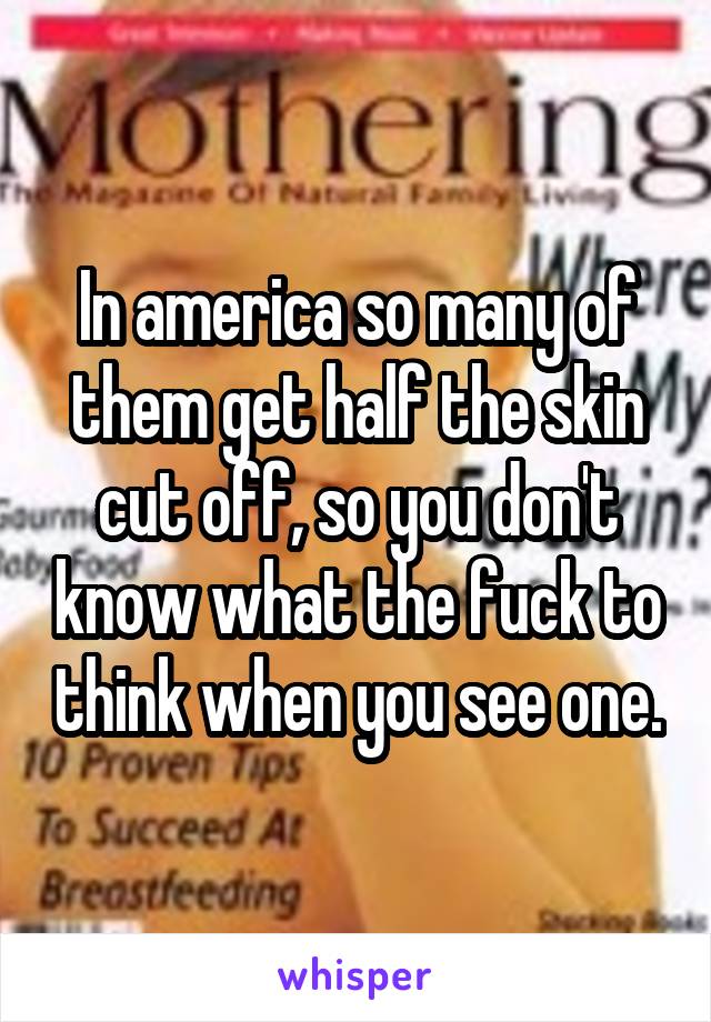 In america so many of them get half the skin cut off, so you don't know what the fuck to think when you see one.