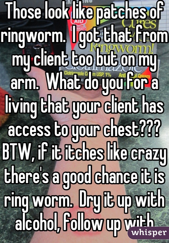 Those look like patches of ringworm.  I got that from my client too but on my arm.  What do you for a living that your client has access to your chest???  BTW, if it itches like crazy there's a good chance it is ring worm.  Dry it up with alcohol, follow up with lamisil. 