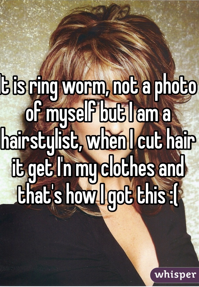 It is ring worm, not a photo of myself but I am a hairstylist, when I cut hair it get I'n my clothes and that's how I got this :( 