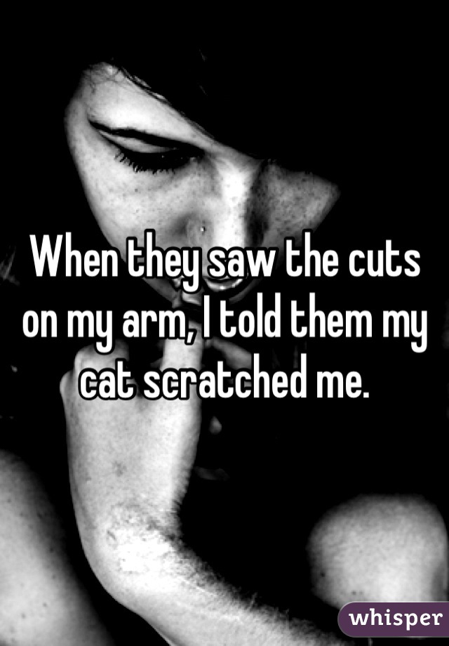 When they saw the cuts on my arm, I told them my cat scratched me.