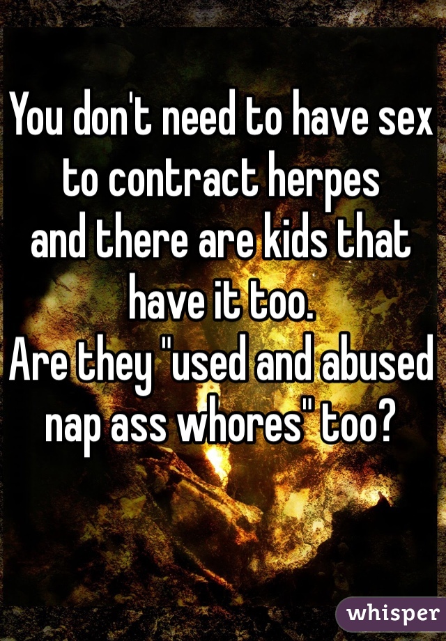 You don't need to have sex to contract herpes
and there are kids that have it too.
Are they "used and abused nap ass whores" too?
