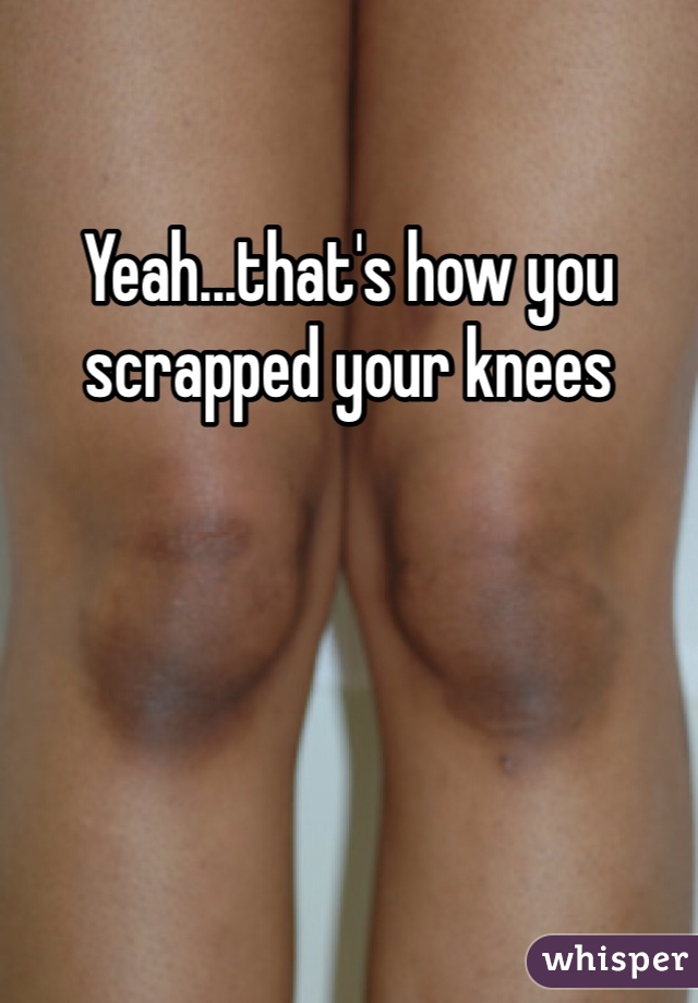 Yeah...that's how you scrapped your knees