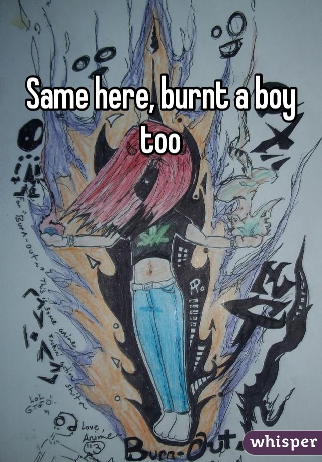 Same here, burnt a boy too