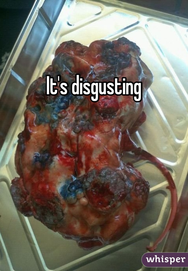 It's disgusting 