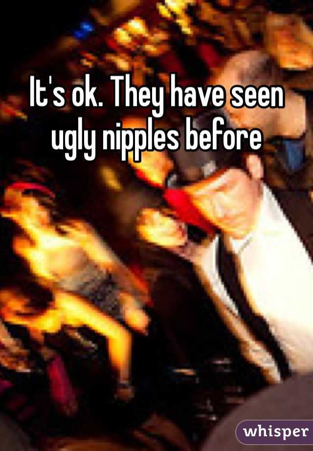 It's ok. They have seen ugly nipples before