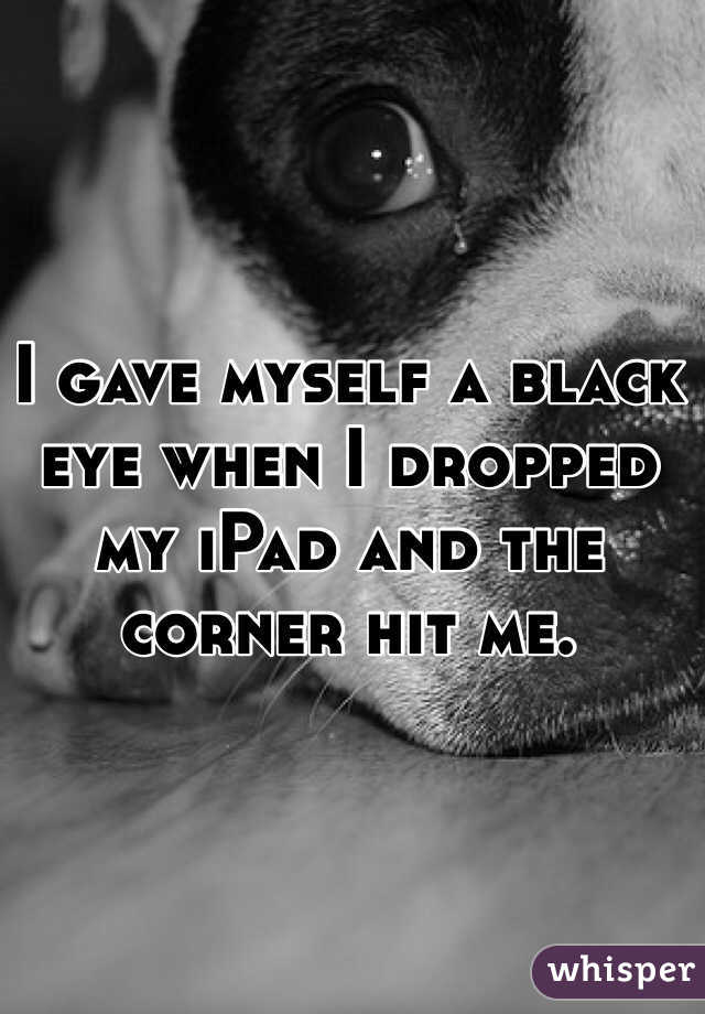 I gave myself a black eye when I dropped my iPad and the corner hit me. 