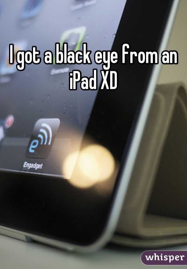 I got a black eye from an iPad XD

