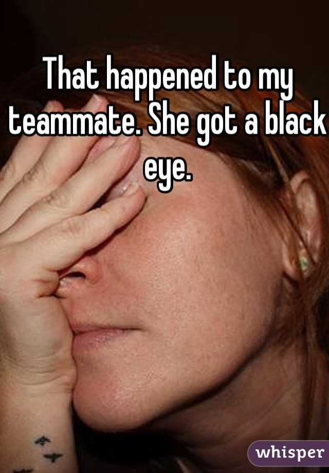 That happened to my teammate. She got a black eye. 