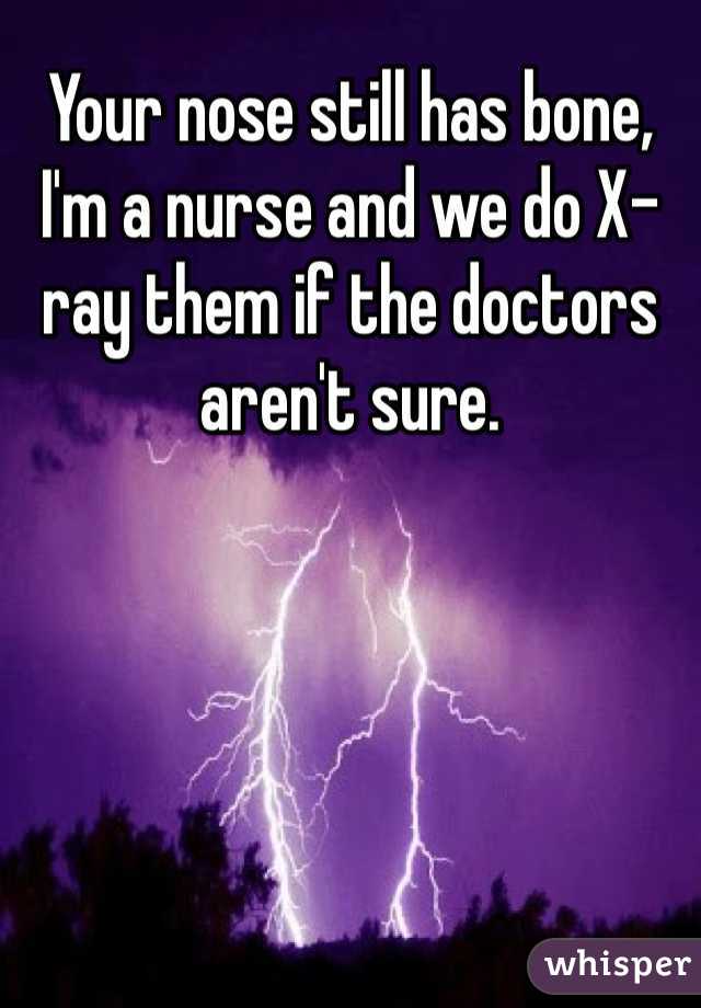 Your nose still has bone, I'm a nurse and we do X-ray them if the doctors aren't sure.