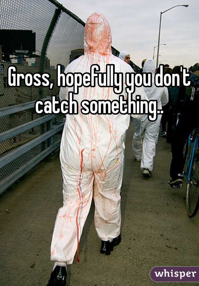 Gross, hopefully you don't catch something.. 