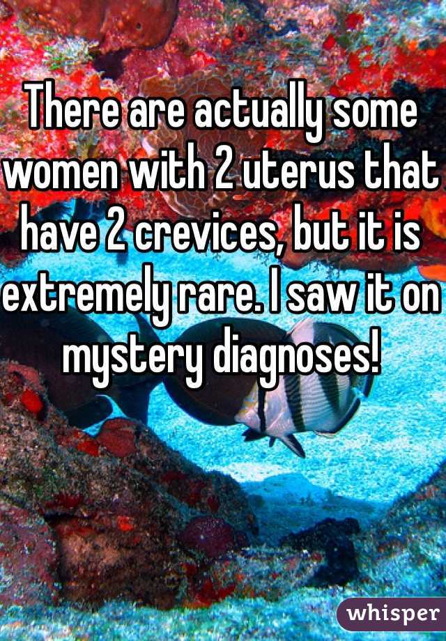 There are actually some women with 2 uterus that have 2 crevices, but it is extremely rare. I saw it on mystery diagnoses! 