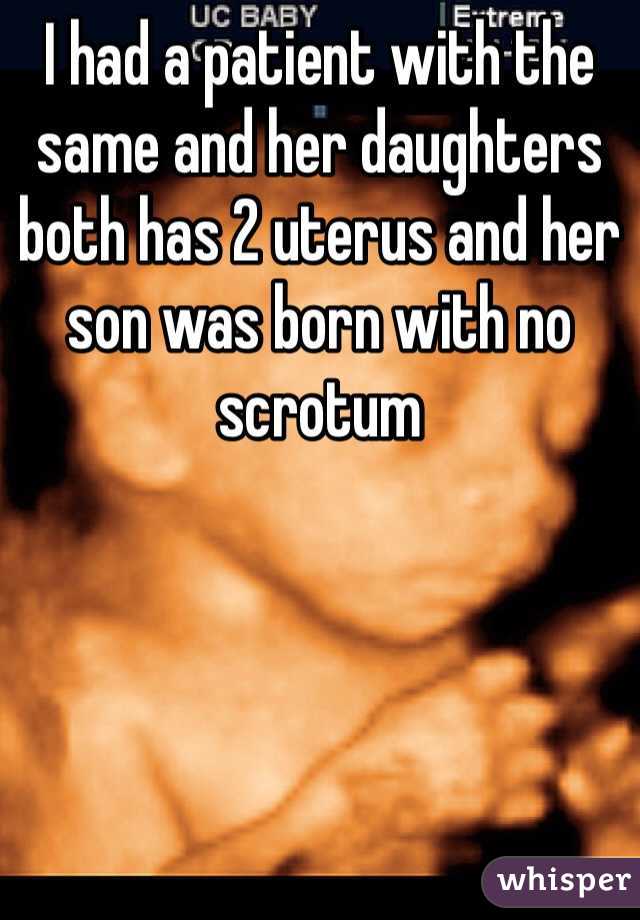 I had a patient with the same and her daughters both has 2 uterus and her son was born with no scrotum