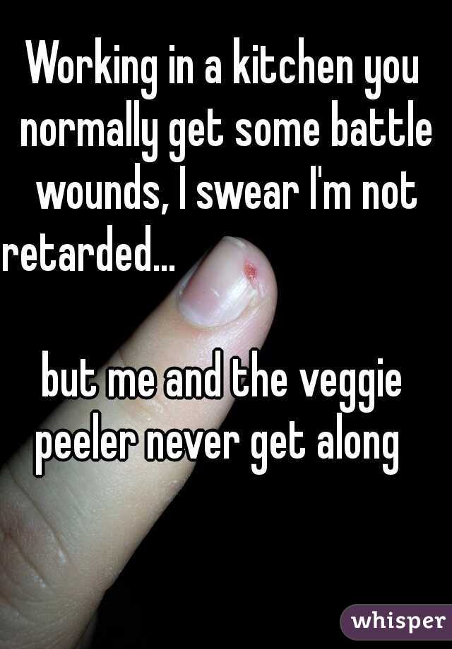 Working in a kitchen you normally get some battle wounds, I swear I'm not retarded...                                  






but me and the veggie peeler never get along  