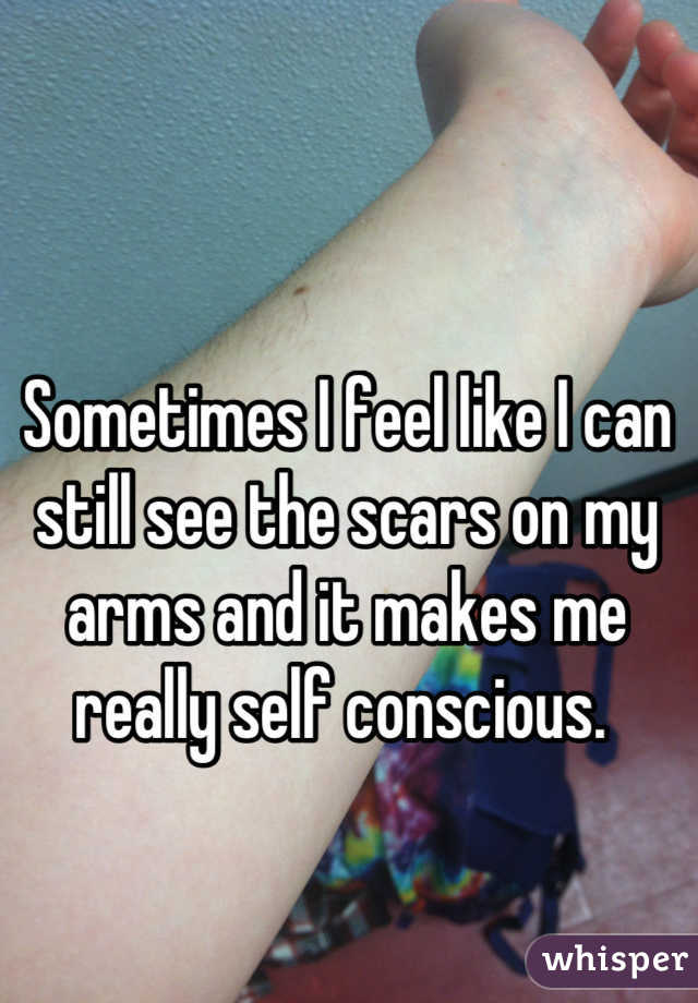 Sometimes I feel like I can still see the scars on my arms and it makes me really self conscious. 