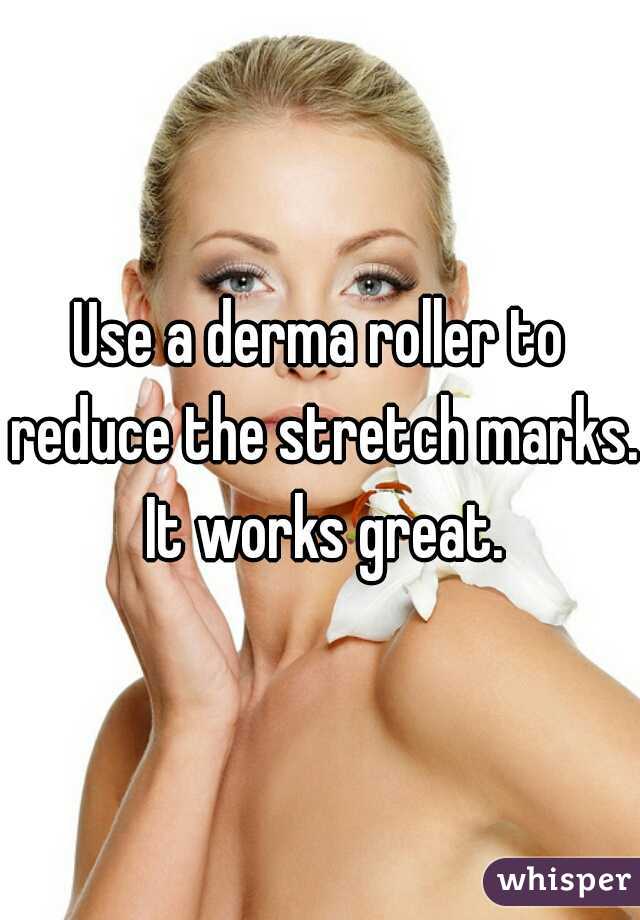 Use a derma roller to reduce the stretch marks. It works great.