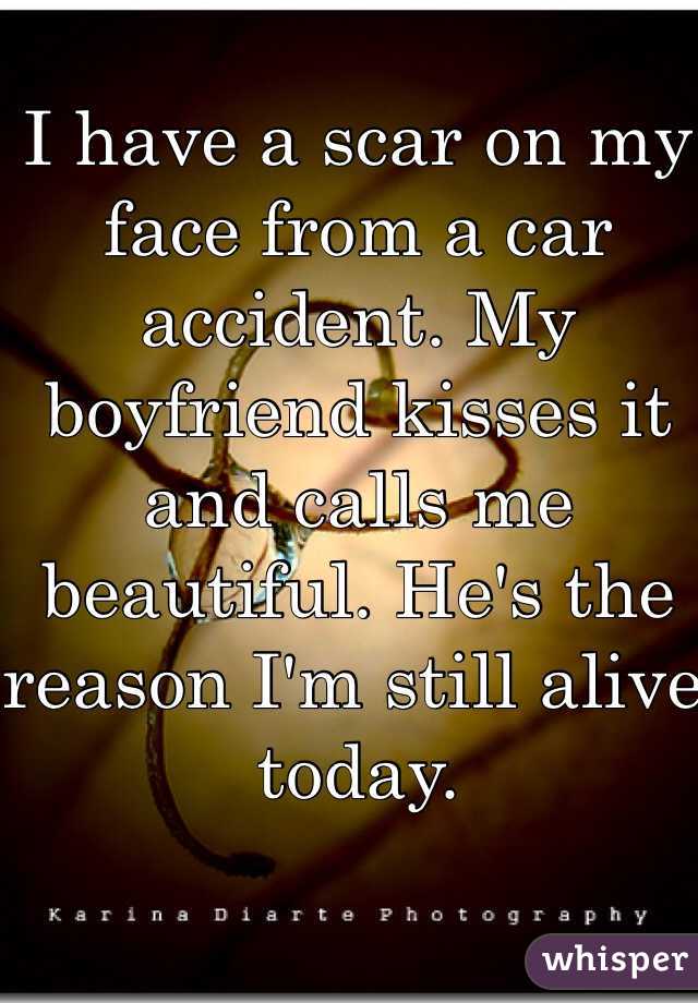 I have a scar on my face from a car accident. My boyfriend kisses it and calls me beautiful. He's the reason I'm still alive today.
