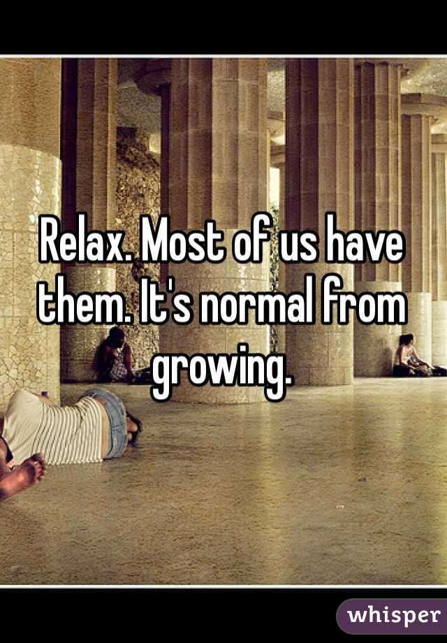 Relax. Most of us have them. It's normal from growing.