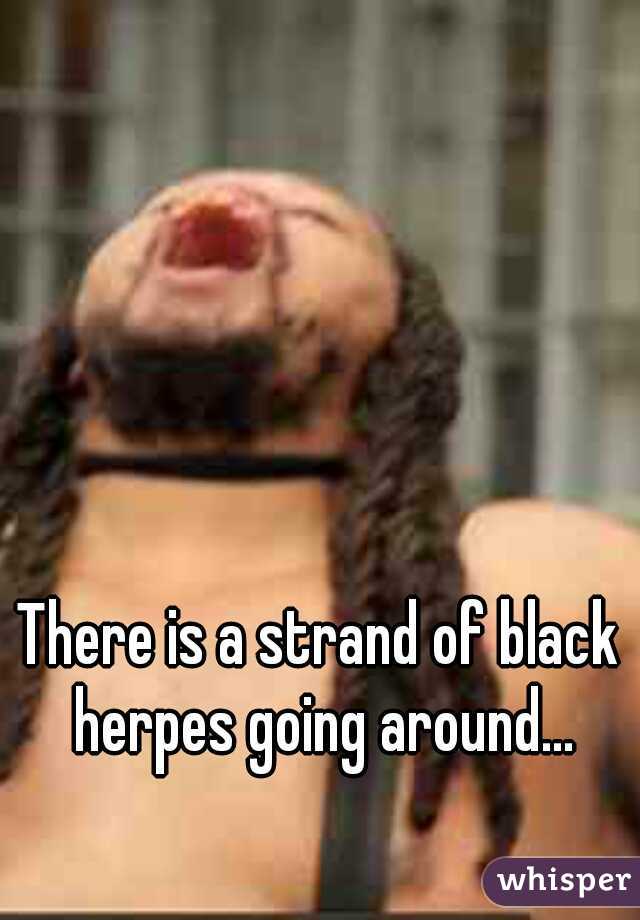 There is a strand of black herpes going around...