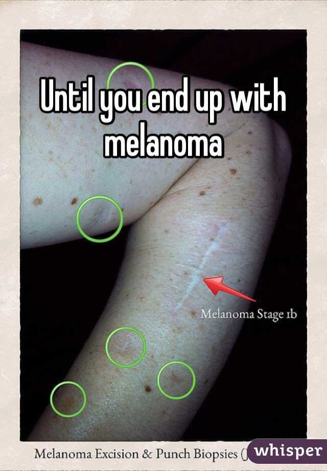 Until you end up with melanoma 