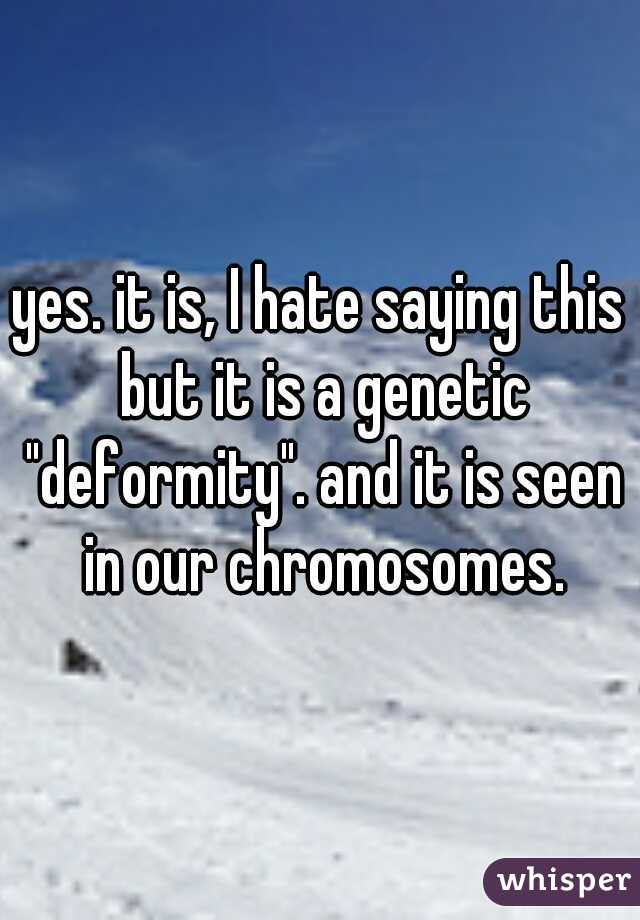 yes. it is, I hate saying this but it is a genetic "deformity". and it is seen in our chromosomes.