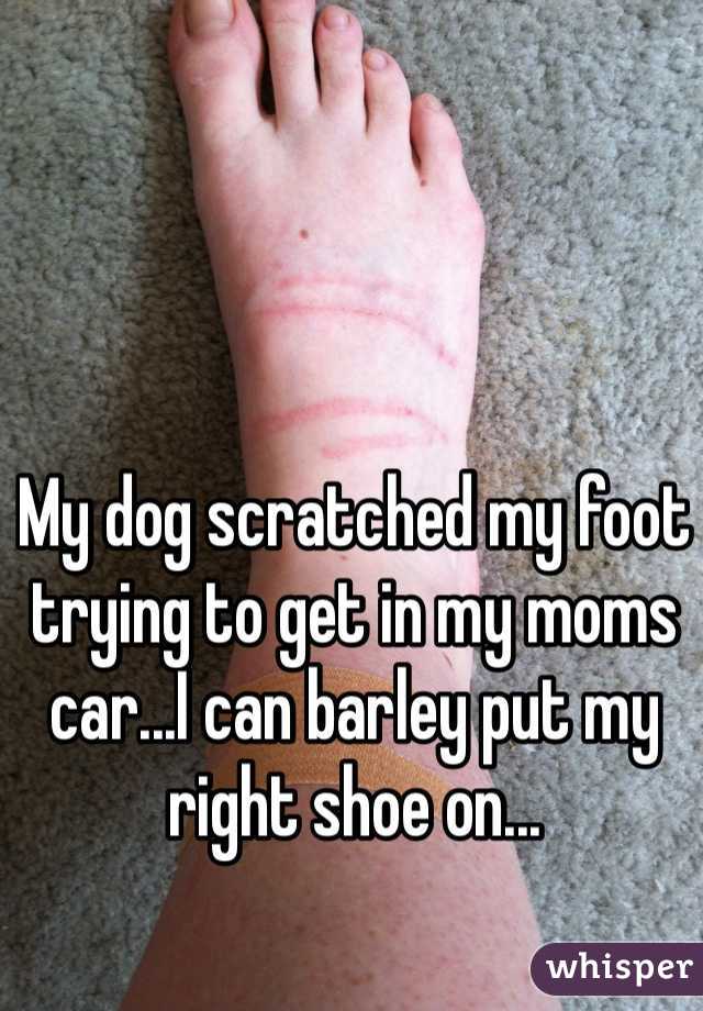 My dog scratched my foot trying to get in my moms car...I can barley put my right shoe on...
