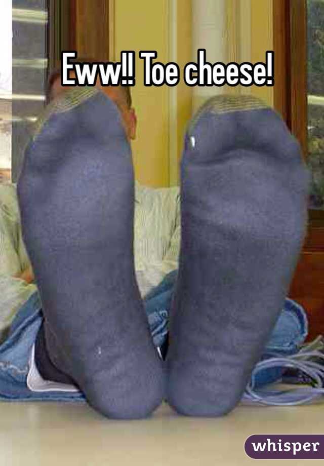 Eww!! Toe cheese!