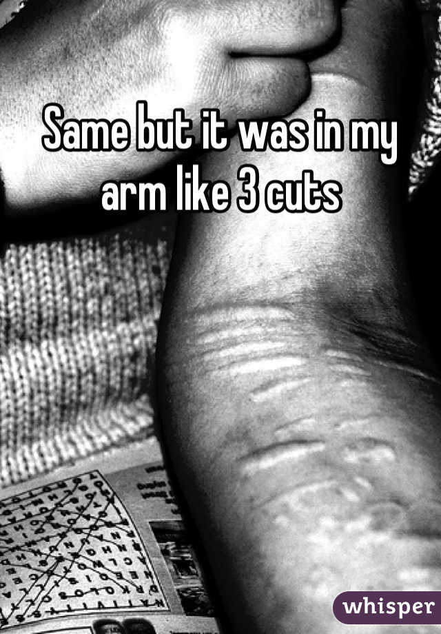 Same but it was in my arm like 3 cuts
