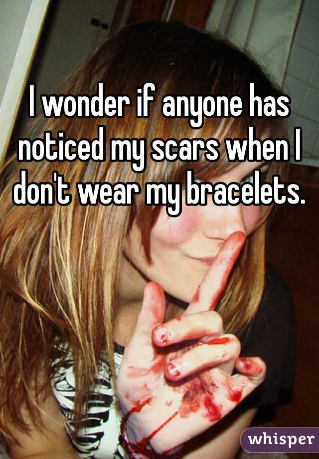 I wonder if anyone has noticed my scars when I don't wear my bracelets. 