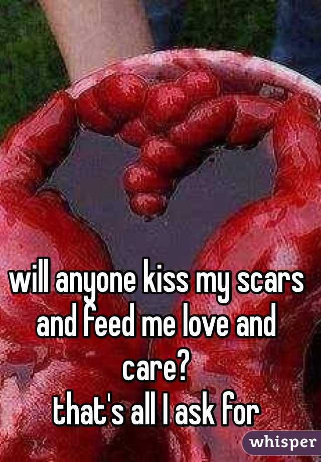 will anyone kiss my scars and feed me love and care? 
that's all I ask for 