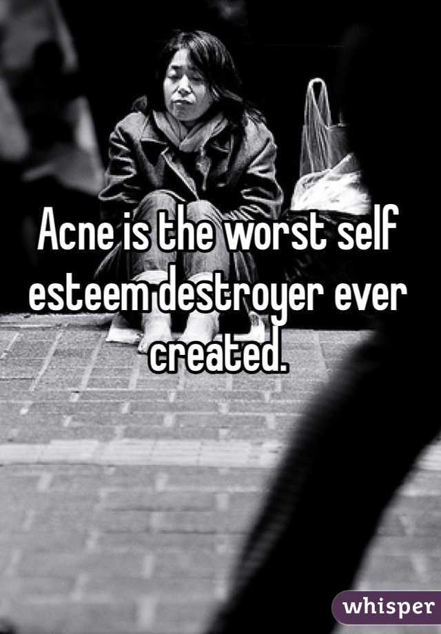 Acne is the worst self esteem destroyer ever created.
