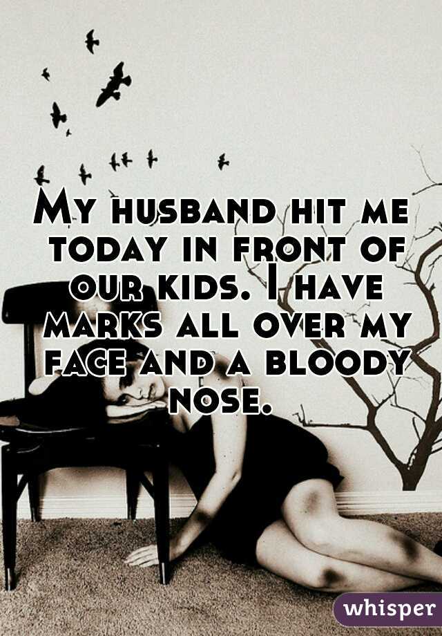 My husband hit me today in front of our kids. I have marks all over my face and a bloody nose. 
 