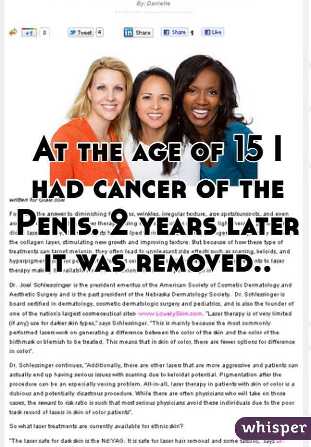 At the age of 15 I had cancer of the Penis. 2 years later it was removed..