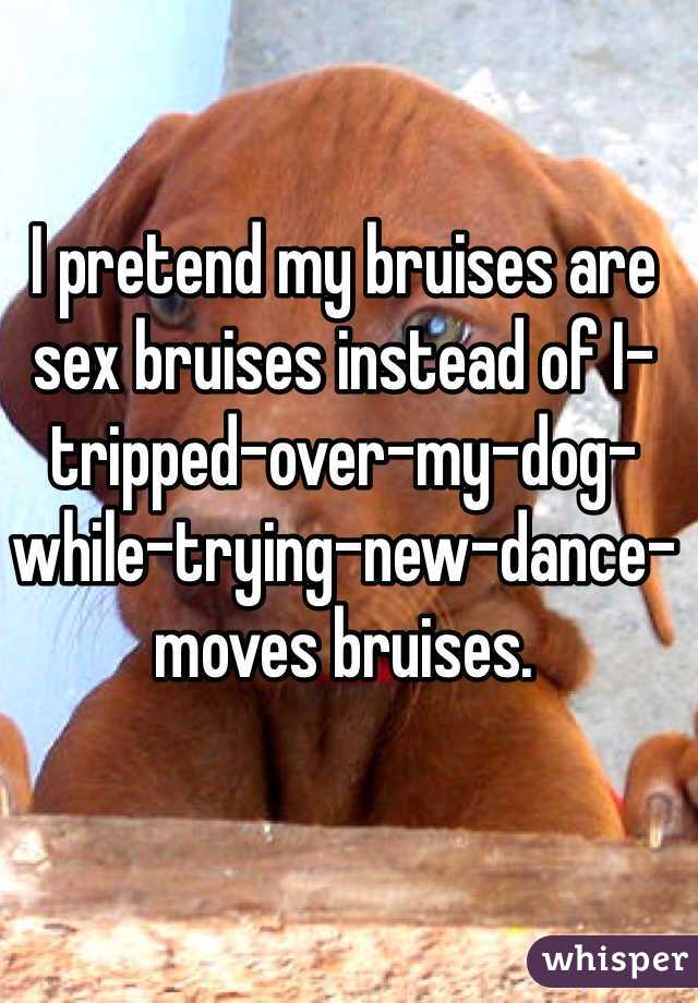 I pretend my bruises are sex bruises instead of I-tripped-over-my-dog-while-trying-new-dance-moves bruises. 