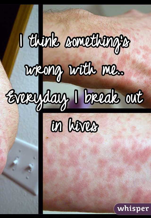 I think something's wrong with me.. Everyday I break out in hives 