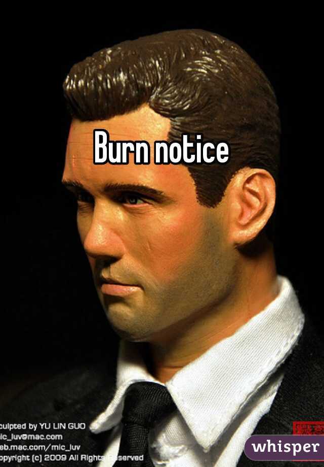 Burn notice 