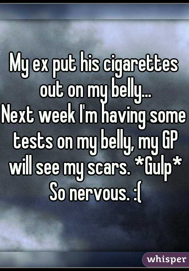 My ex put his cigarettes out on my belly...

Next week I'm having some tests on my belly, my GP will see my scars. *Gulp* So nervous. :(