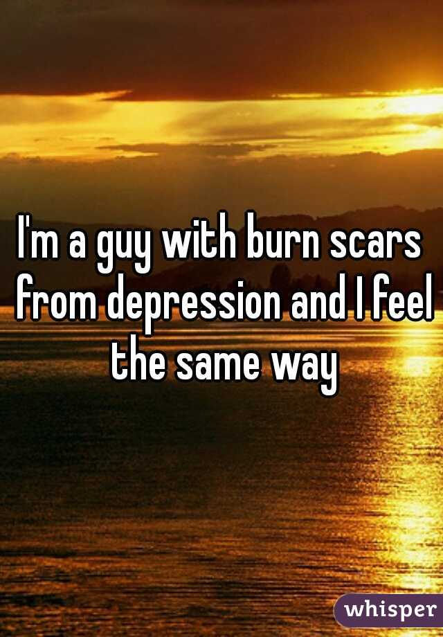 I'm a guy with burn scars from depression and I feel the same way