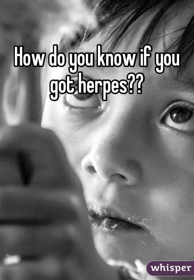 How do you know if you got herpes??
