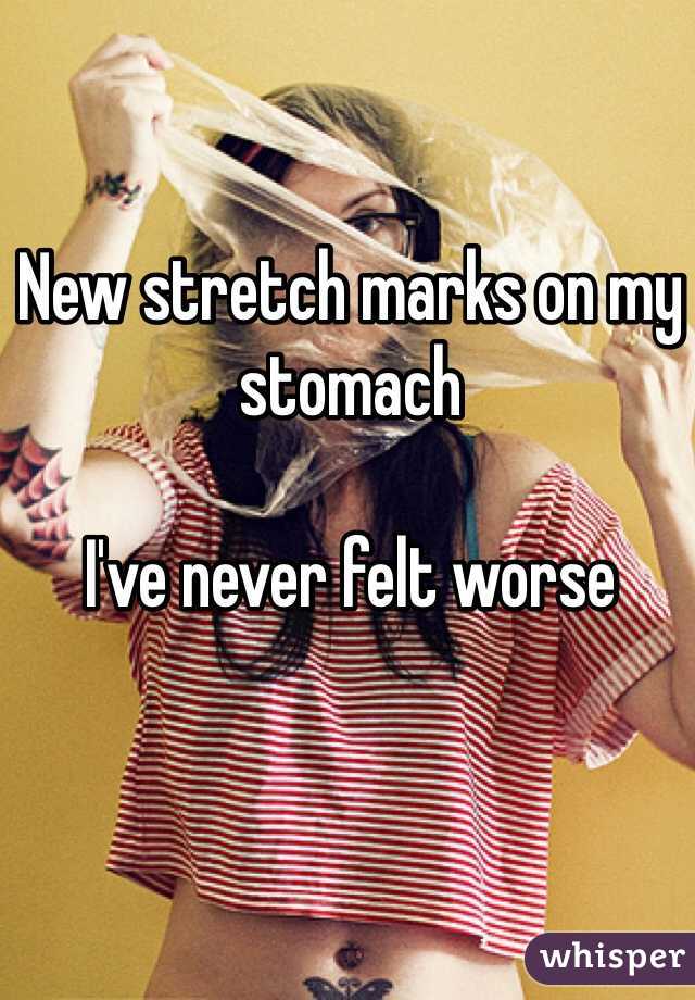 New stretch marks on my stomach 

I've never felt worse 