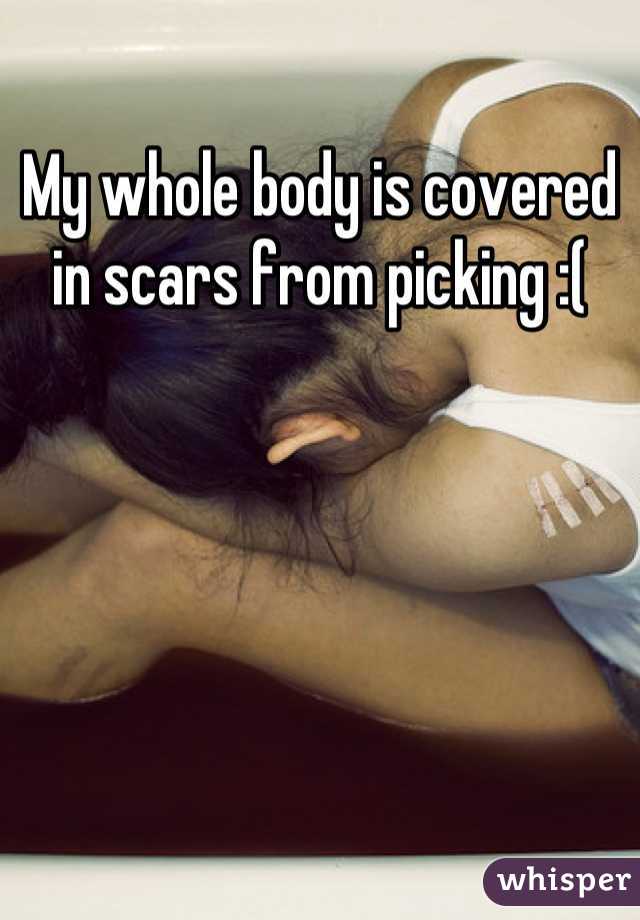 My whole body is covered in scars from picking :(