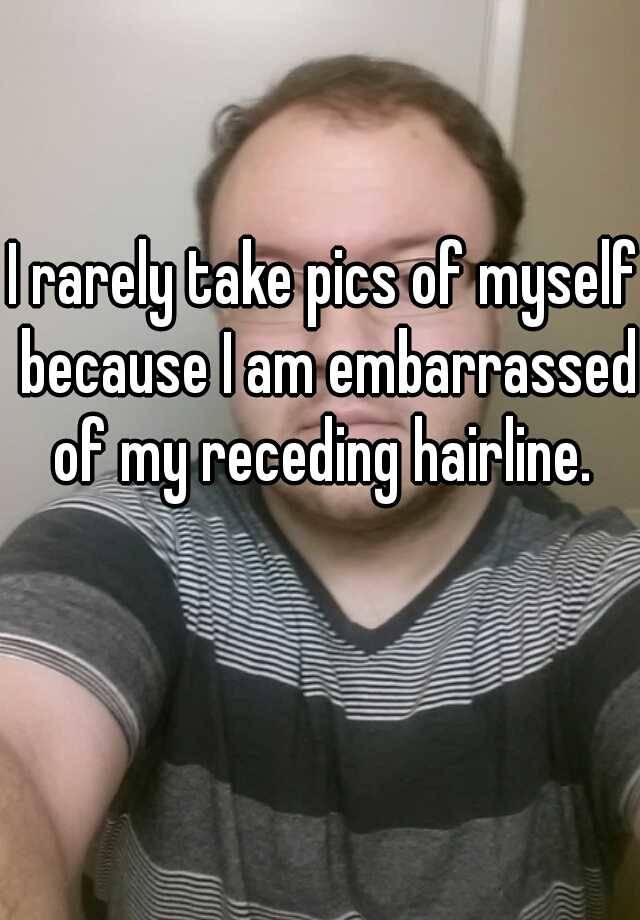 I rarely take pics of myself because I am embarrassed of my receding hairline. 