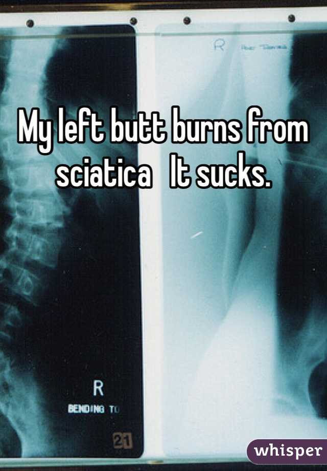 My left butt burns from sciatica   It sucks.  