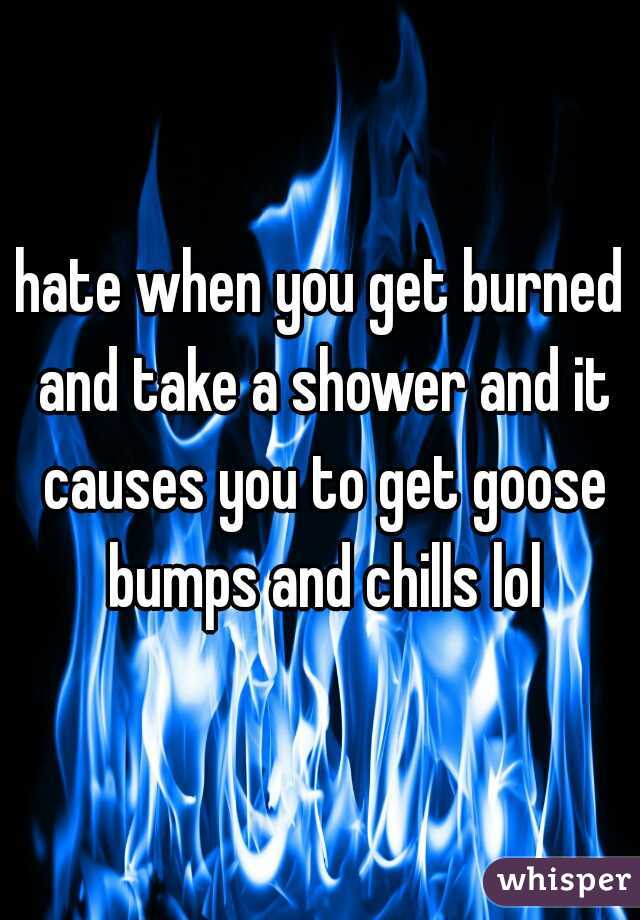 hate when you get burned and take a shower and it causes you to get goose bumps and chills lol