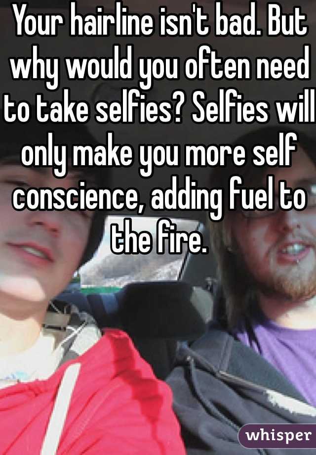 Your hairline isn't bad. But  why would you often need to take selfies? Selfies will only make you more self conscience, adding fuel to the fire. 